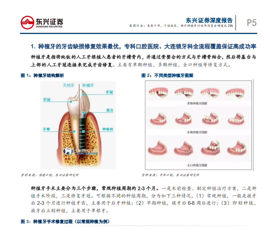 未來(lái)十年，十倍成長(zhǎng)，預(yù) 計(jì)種植牙行業(yè)年均復(fù)合增速達(dá)25%——東興證券